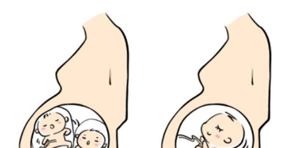 多胎妊娠.png