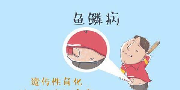 第三代试管婴儿技术能够阻隔寻常型鱼鳞病的遗传！