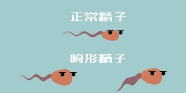 男性精子畸形率高做试管婴儿能成功吗