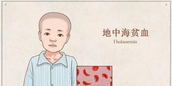 夫妻都有地中海贫血能做第三代试管婴儿吗-当然可以！