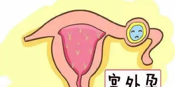 什么情况下做试管婴儿会发生宫外孕-生殖科普