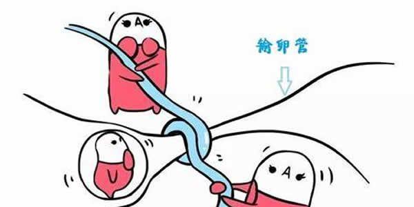 <a style='border-bottom:1px dashed #F00;color:#3a7fde;cursor:pointer;' href='https://www.yi-yun-tong.com/article-4696.html'>输卵管堵塞</a>.jpg