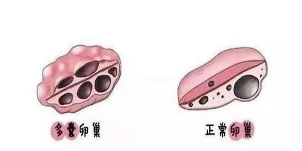 AMH值5.0-6.0还能做试管婴儿吗，成功率有多少