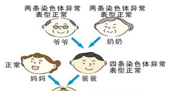 染色体异常