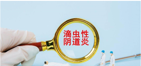 滴虫性阴道炎