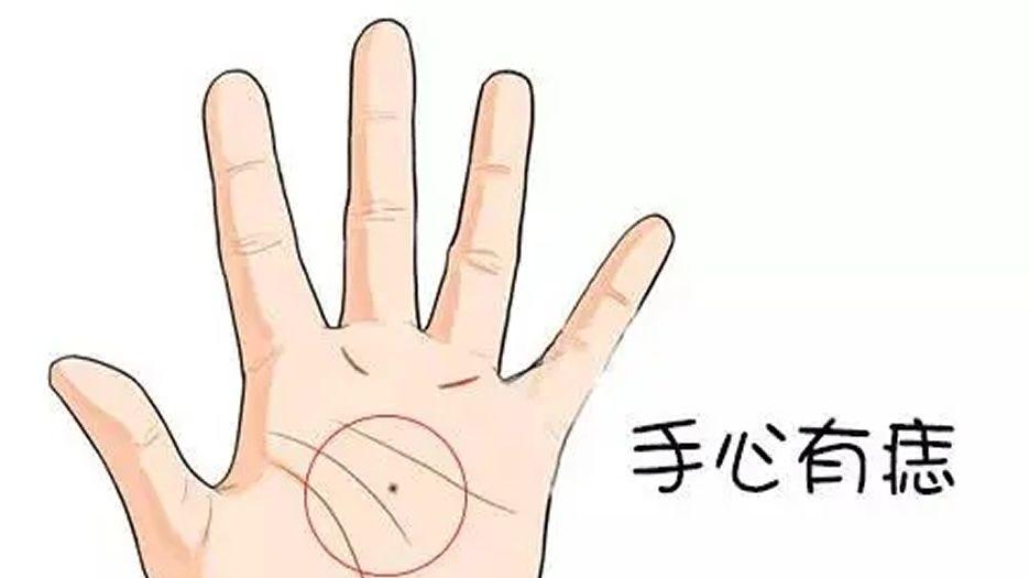 手掌痣.jpg