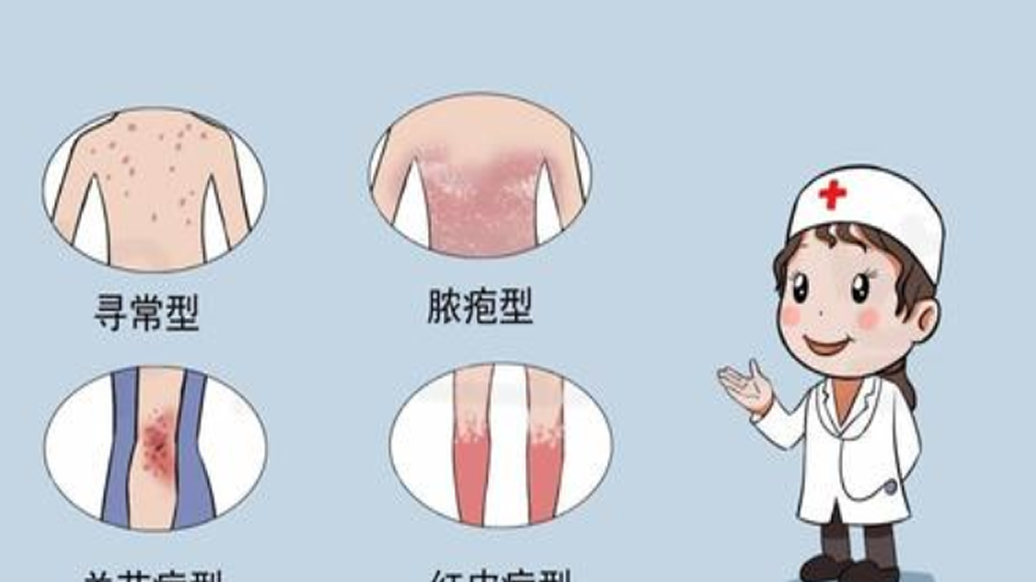 银屑病2.png