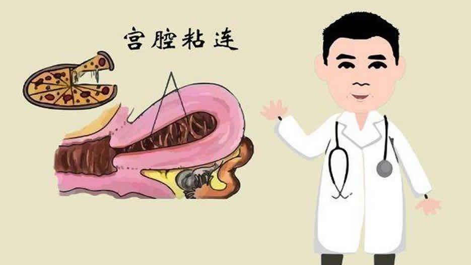 宫腔粘连5.jpg