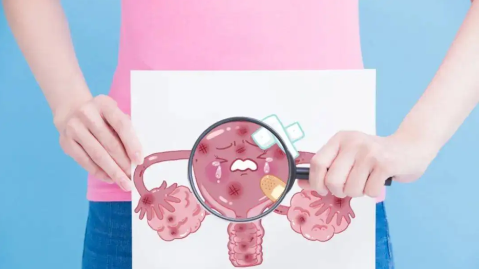 子宫.png