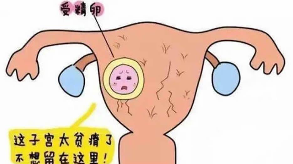 子宫环境1.jpg