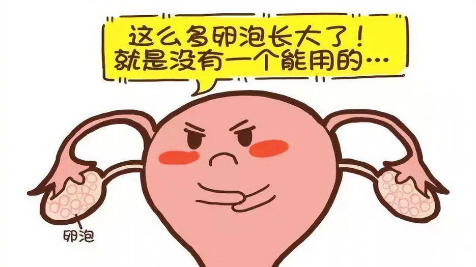 多囊卵巢1.jpg