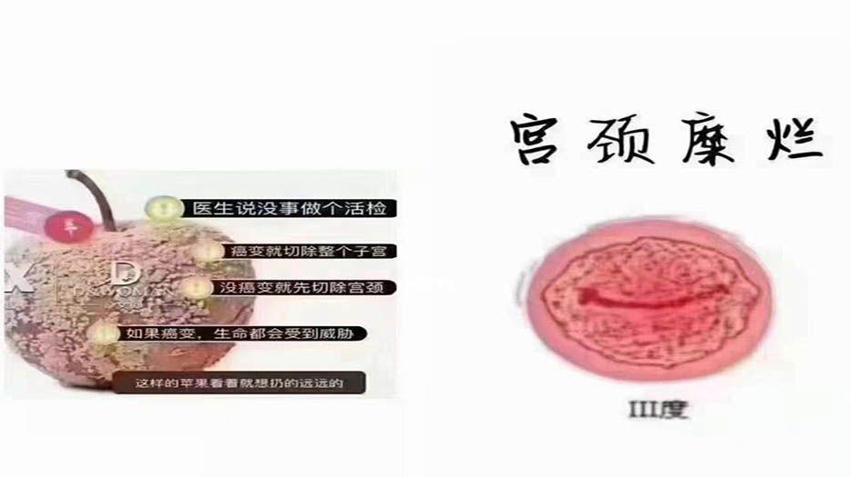 2ef160e2d1e12359450c73dd5548bc0d.jpeg