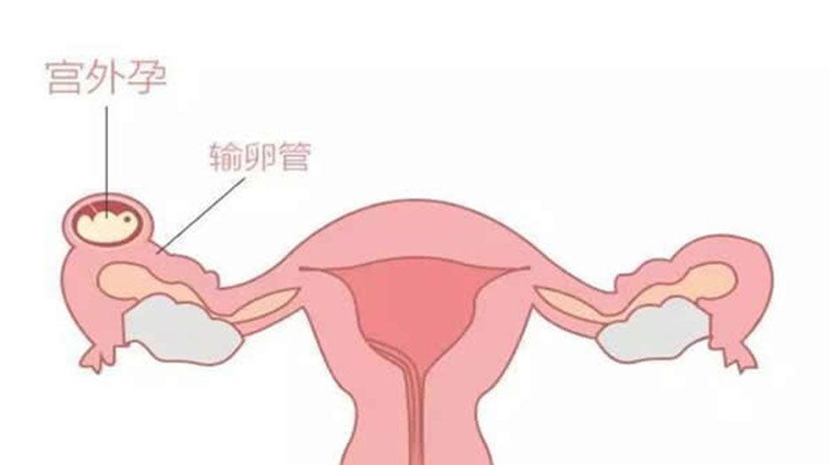 dingyue.nosdn.127.jpg
