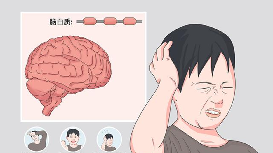 脑蛋白质.png