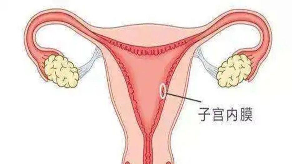 子宫内膜 (2).jpg
