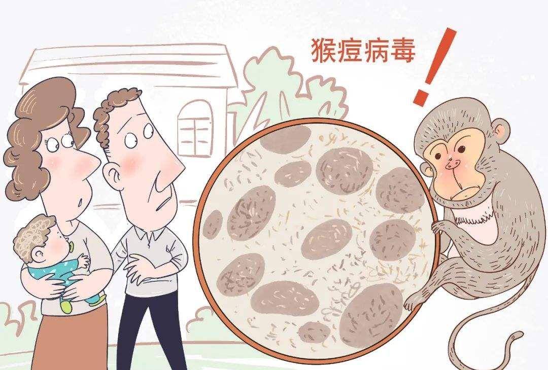 专家称猴痘疫情在美国有失控风险.jpeg