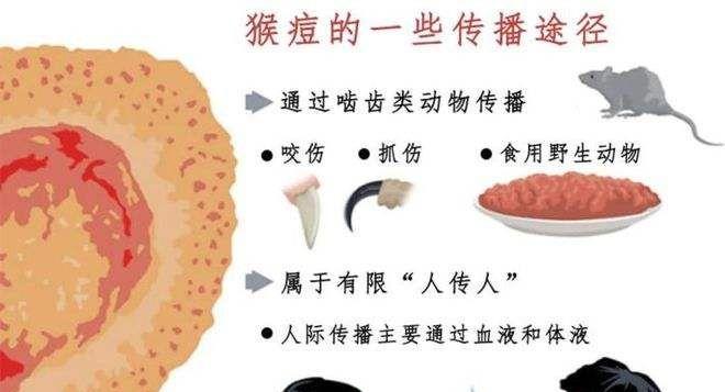专家称猴痘疫情在美国有失控风险.jpeg