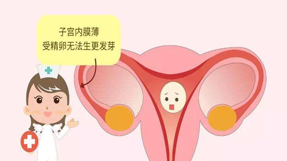 子宫 (2).jpg