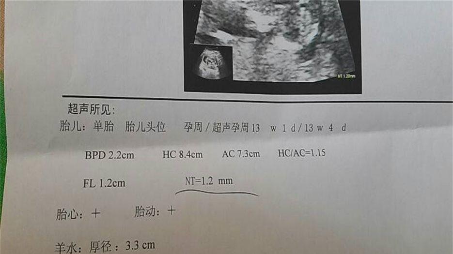 c03264269f04f51b039abaf129868ec7.jpg