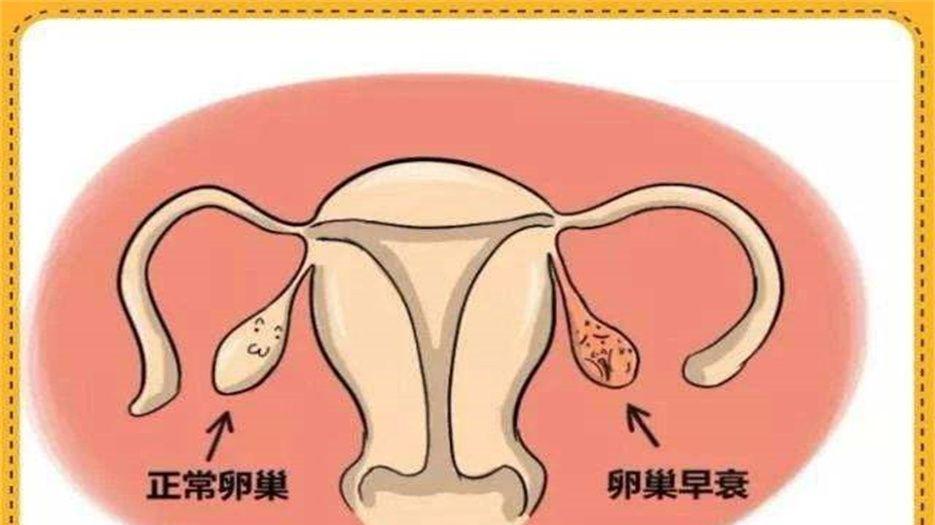 卵巢早衰 (3).jpeg