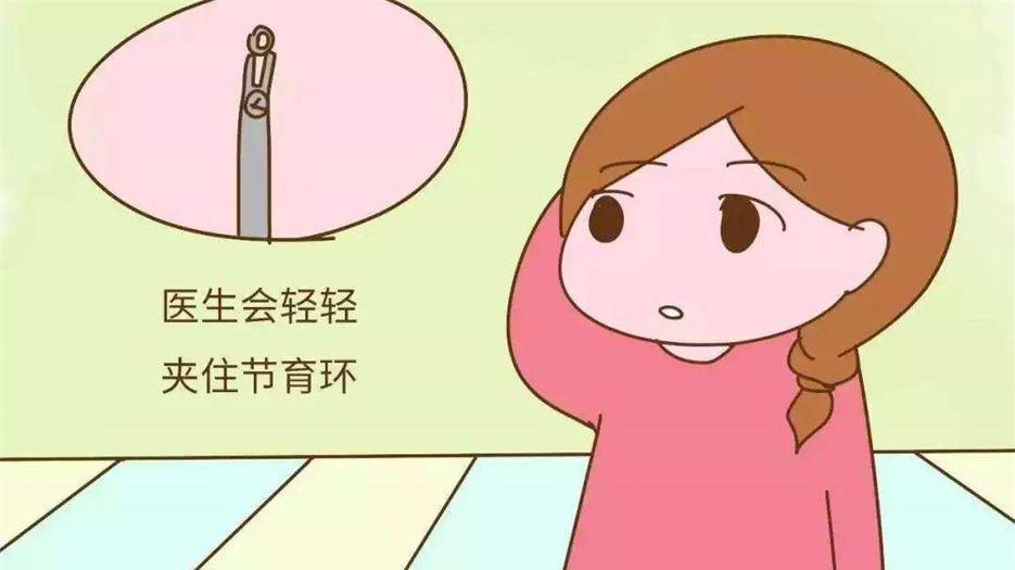 取环1.jpg