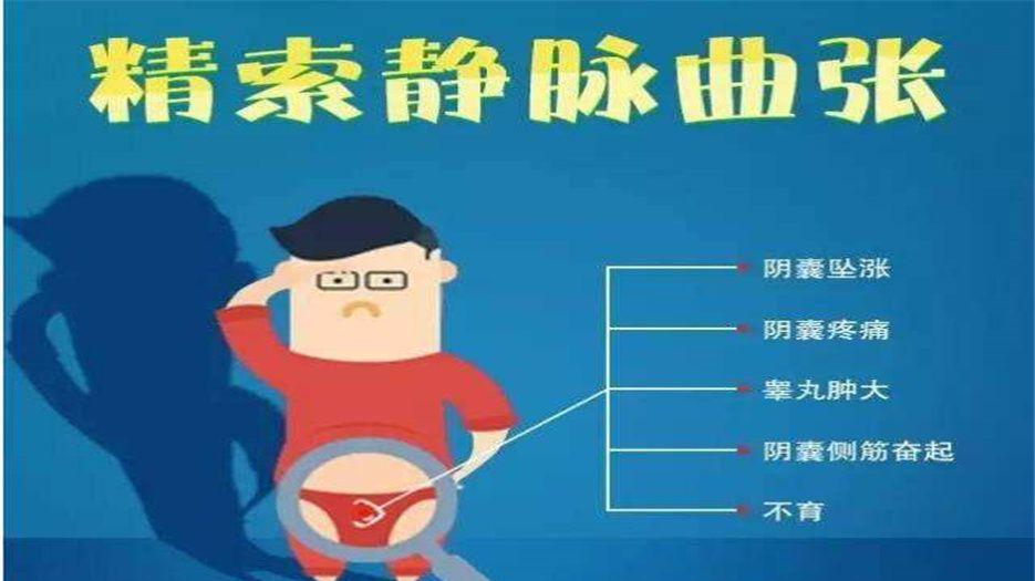 精索静脉曲张 (2).jpg