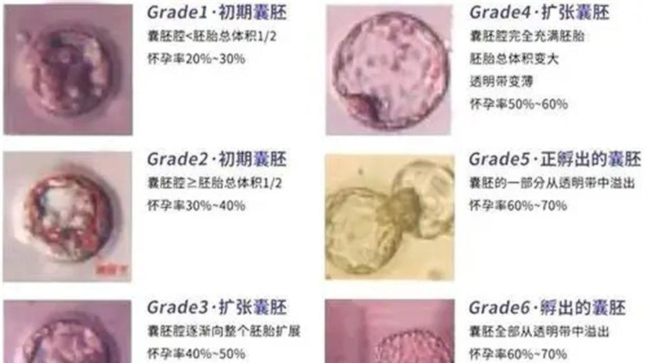 囊胚 (3).jpg