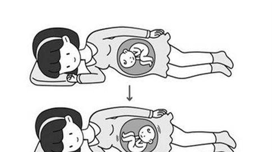 胎位 (1).jpeg