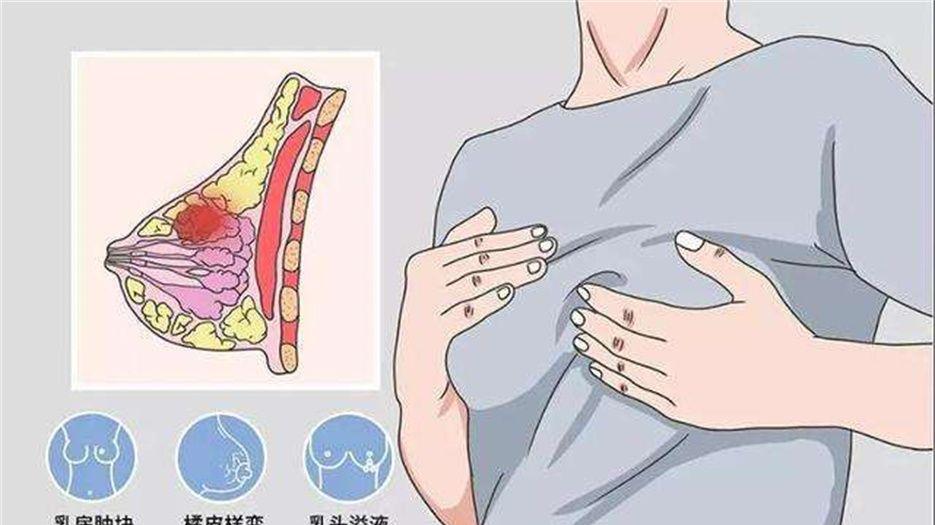 乳腺癌15个发病征兆 (4).jpg