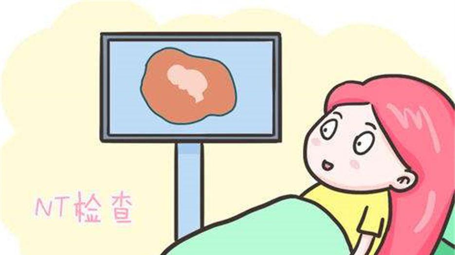 nt检查 (1).jpeg