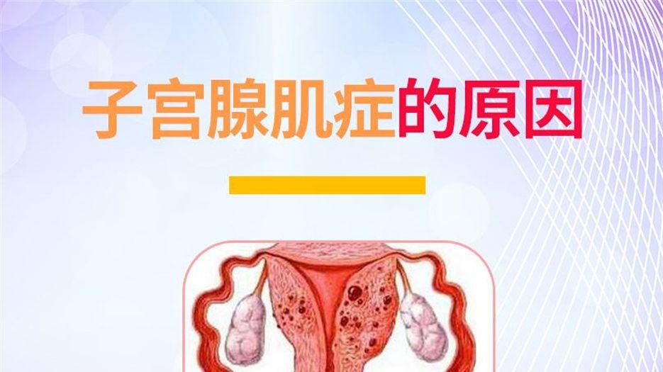 腺肌症 (1).jpeg