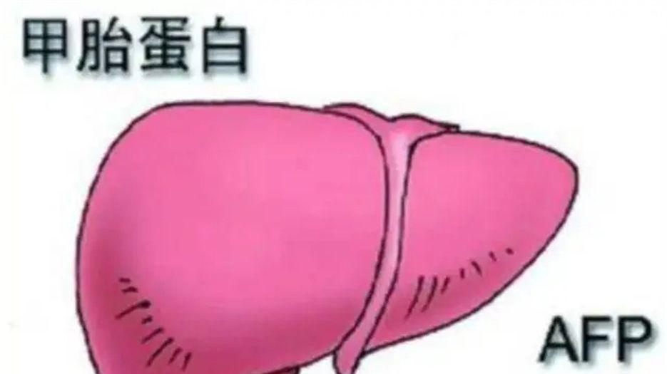 甲胎蛋白 (2).jpg