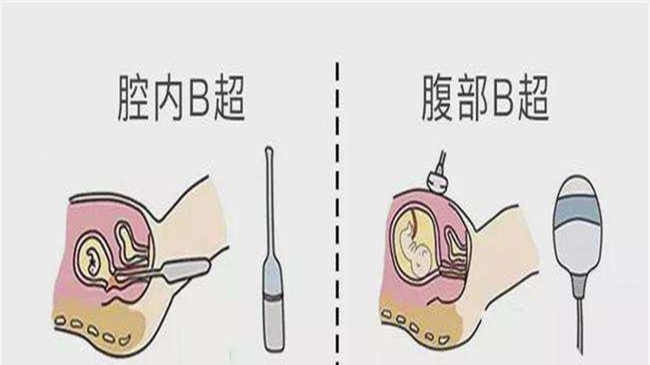阴超 (3).jpeg