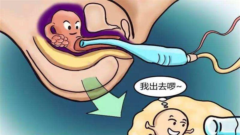 取卵后.jpg