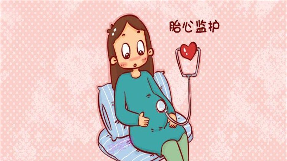 胎心监测 (1).jpeg