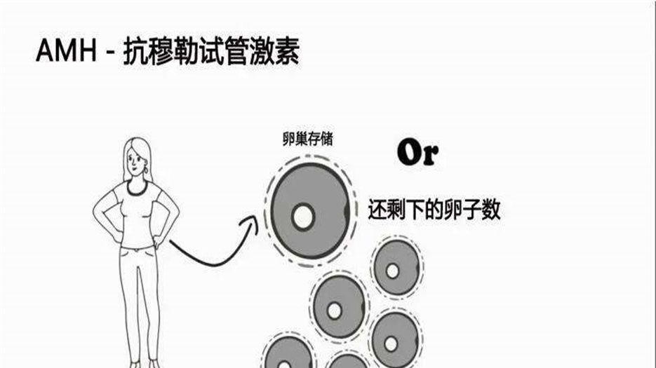 抗缪勒氏激素