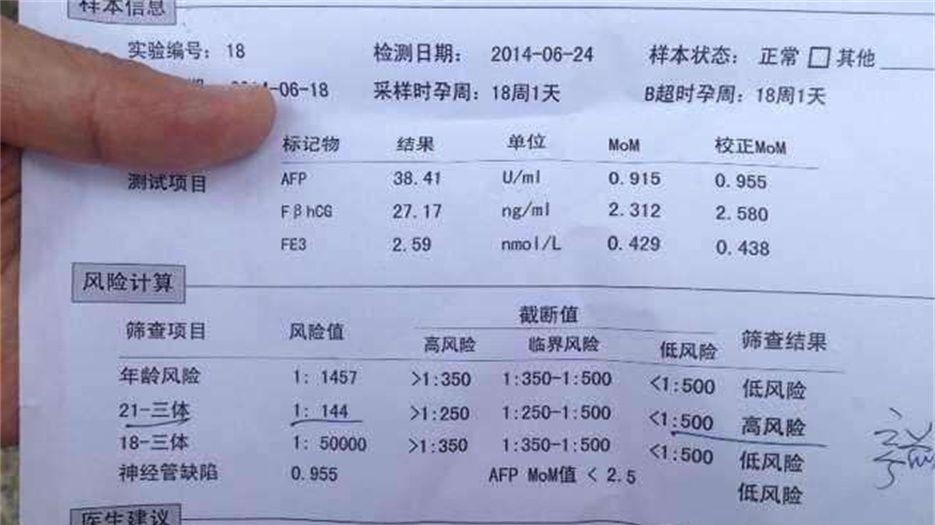 唐氏筛查报告单.jpg