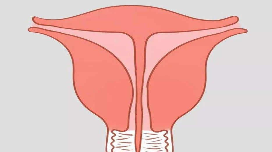 完全纵膈子宫
