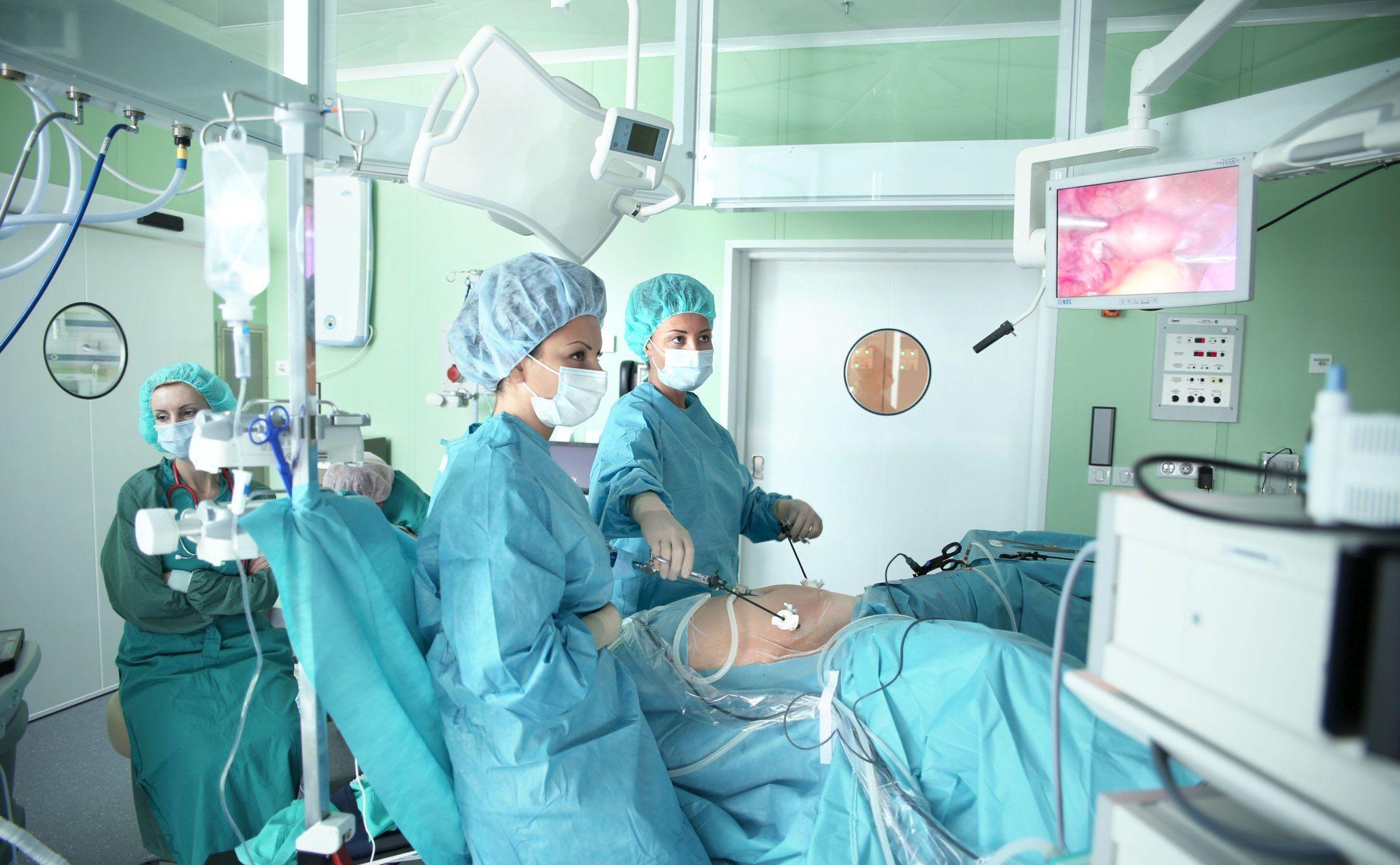 腹腔镜检查