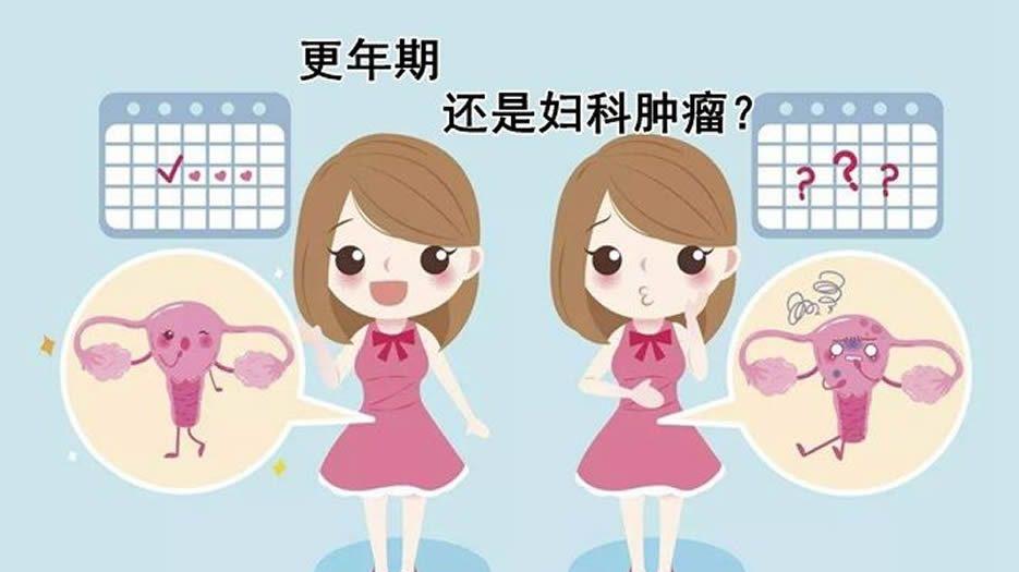 妇科肿瘤