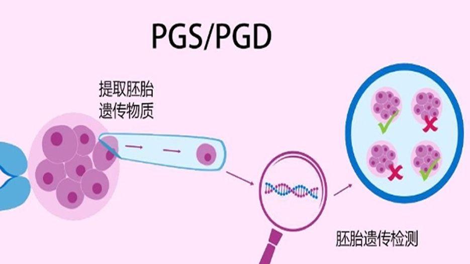 PGS/PGD基因检测