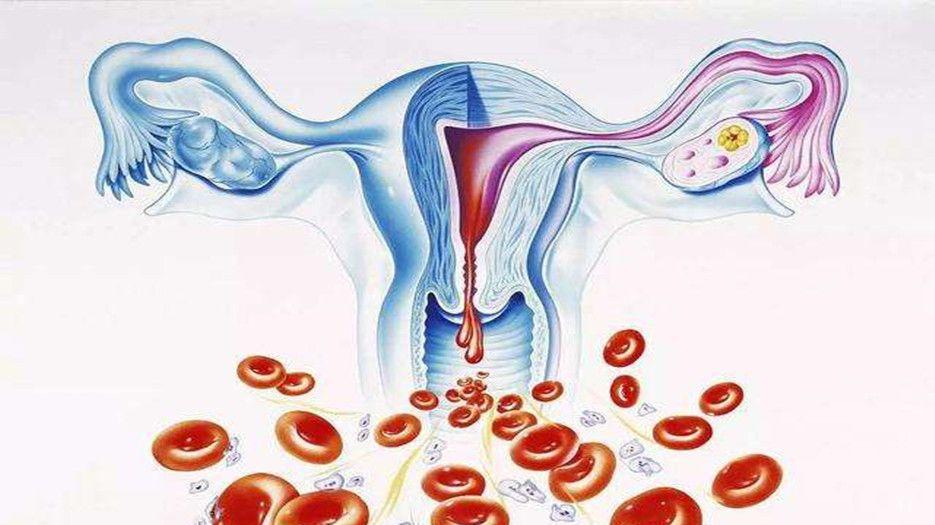什么是女性子宫结核