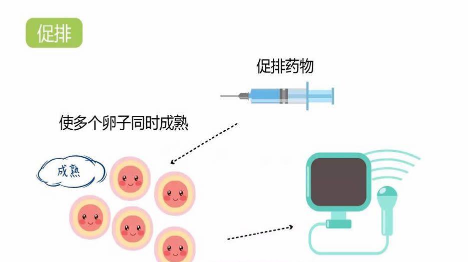 10个基础卵泡适合用什么促排卵方案