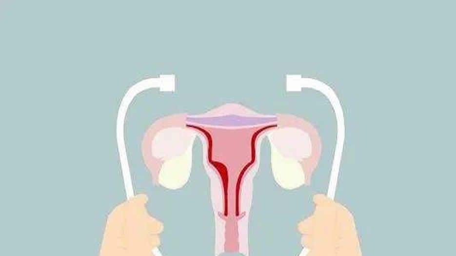 生殖健康
