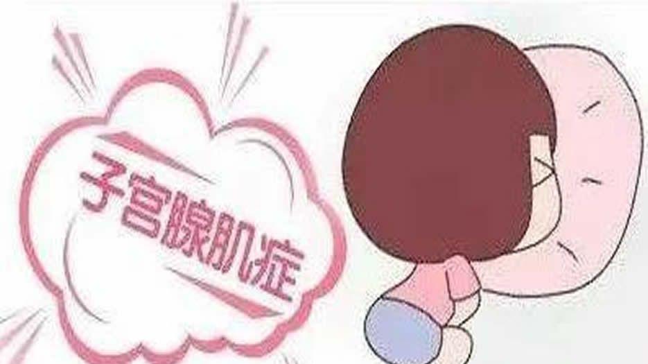 查出得了子宫腺肌症的人