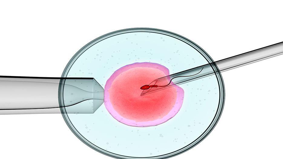 试管ivf.jpg