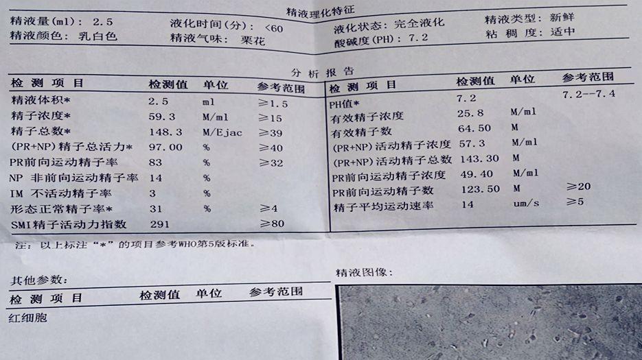 弱精症做试管婴儿会生男宝宝吗？专家解读弱精症和试管婴儿生男宝宝的关系 (12).jpg