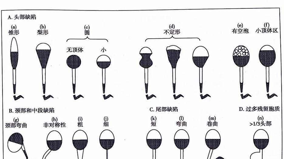二代试管会剔除畸形精子吗？专家解读精子畸形做第几代试管.jpg
