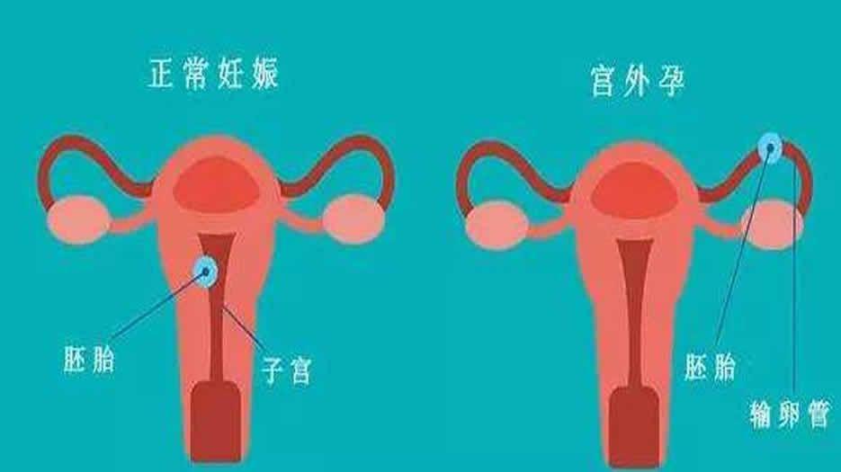 病症