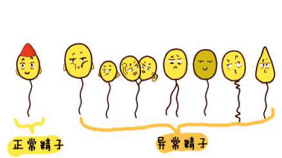 精子